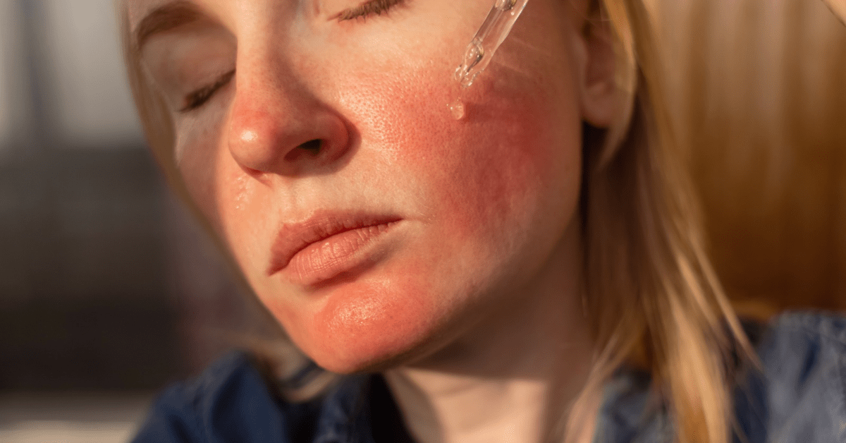 Best Avene Skincare for Sensitive Skin and Redness - French Beauty Co.