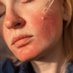 Best Avene Skincare for Sensitive Skin and Redness