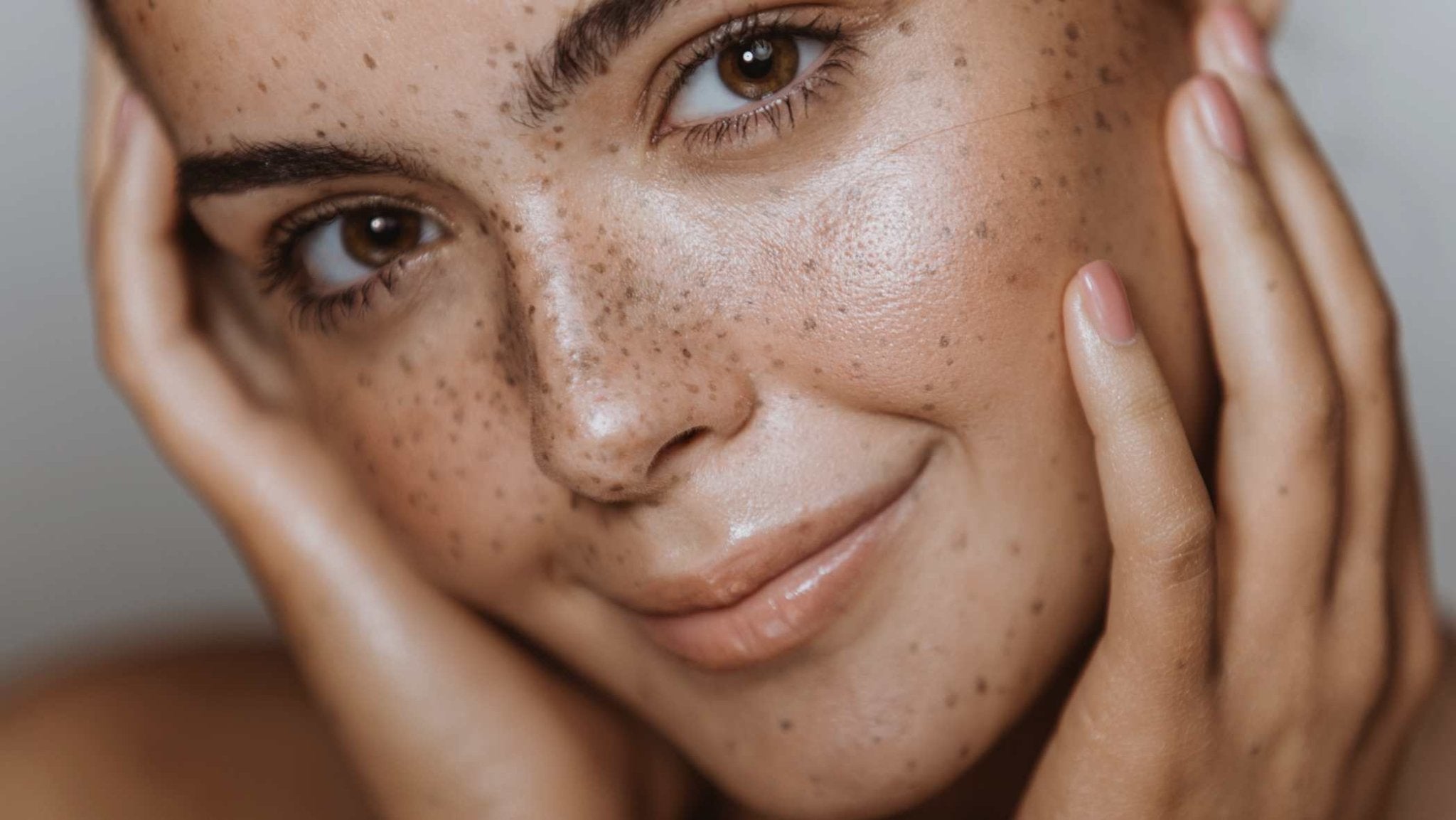 Dealing with Hyperpigmentation: Best Treatment Options For The Skin - French Beauty Co.