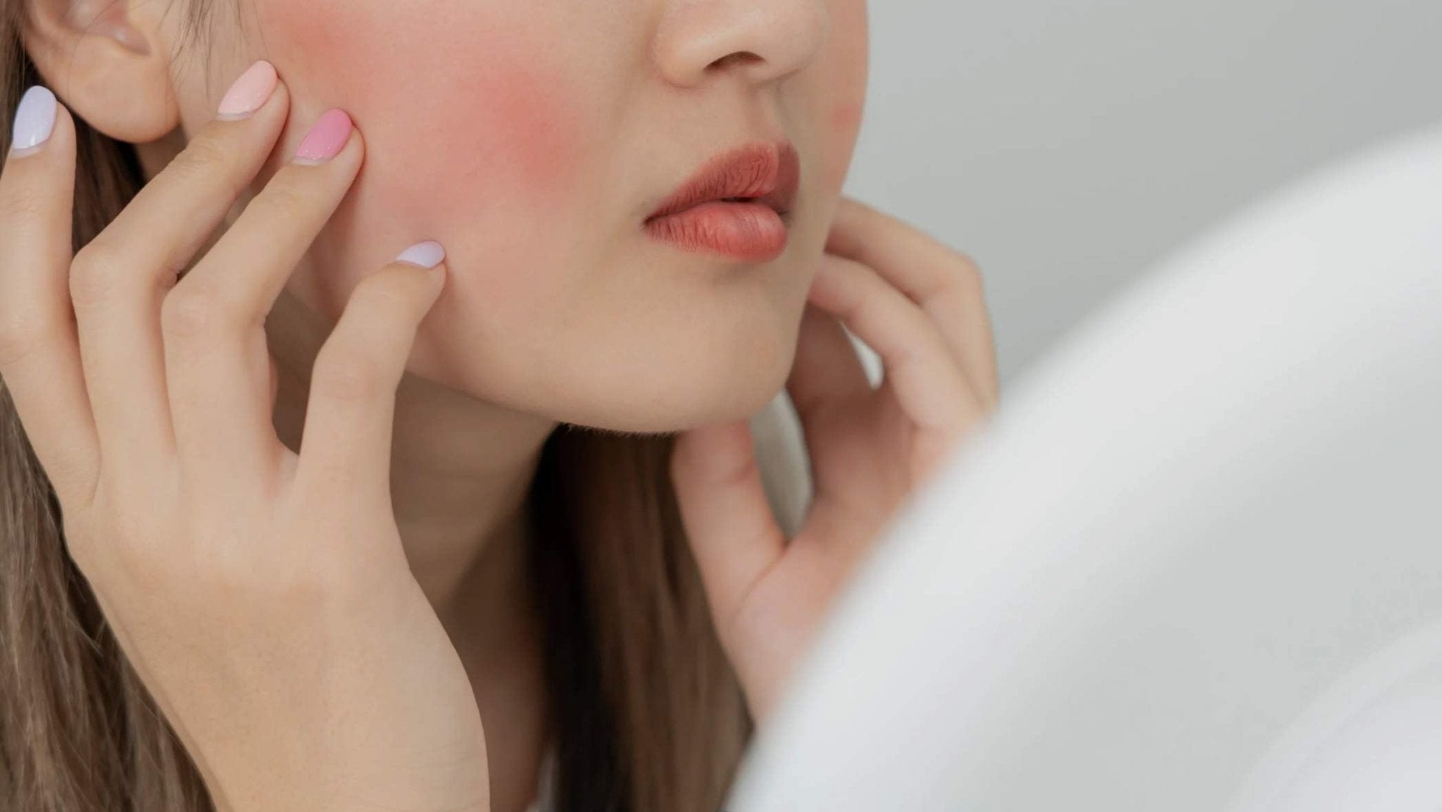 How to Tackle Rosacea: Tips and Solutions - French Beauty Co.