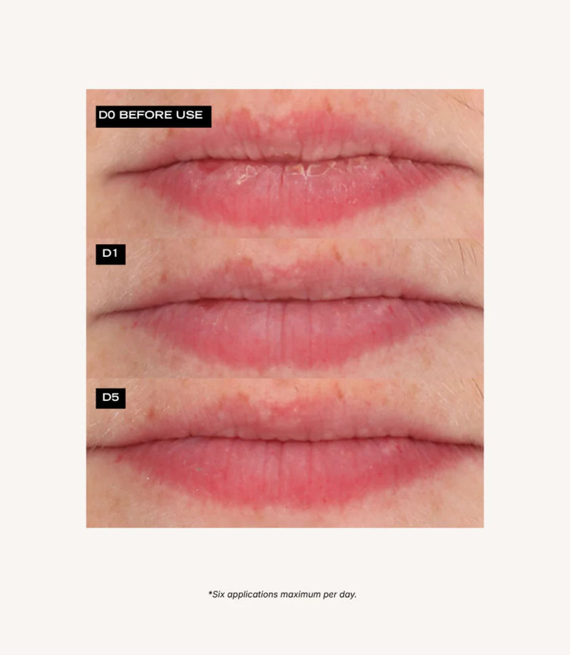 Source Nutrition Nourishing Lip Oil 5ml