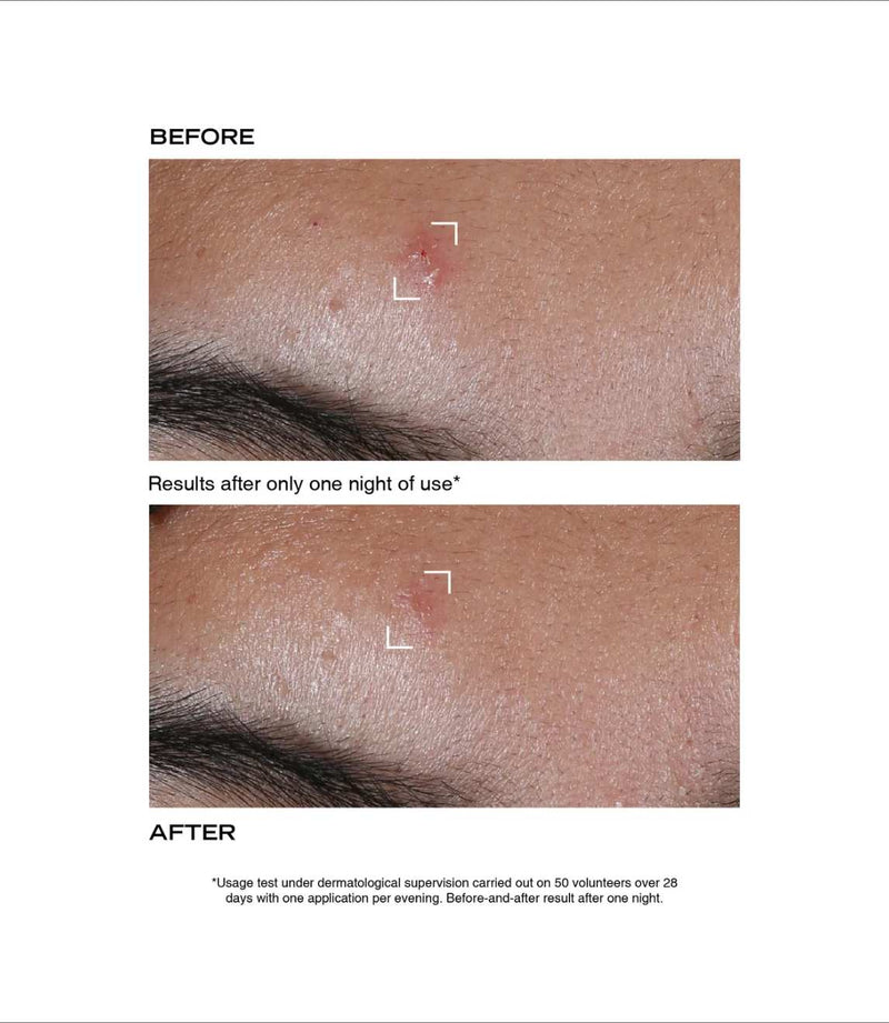 Payot Pate Grise Original Stop Pimple Paste 15ml, French Beauty Co