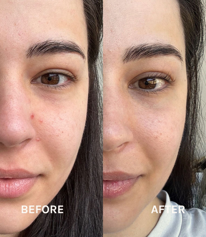 A313 Vitamin A Retinol Pommade 50g - French Beauty Co.A313