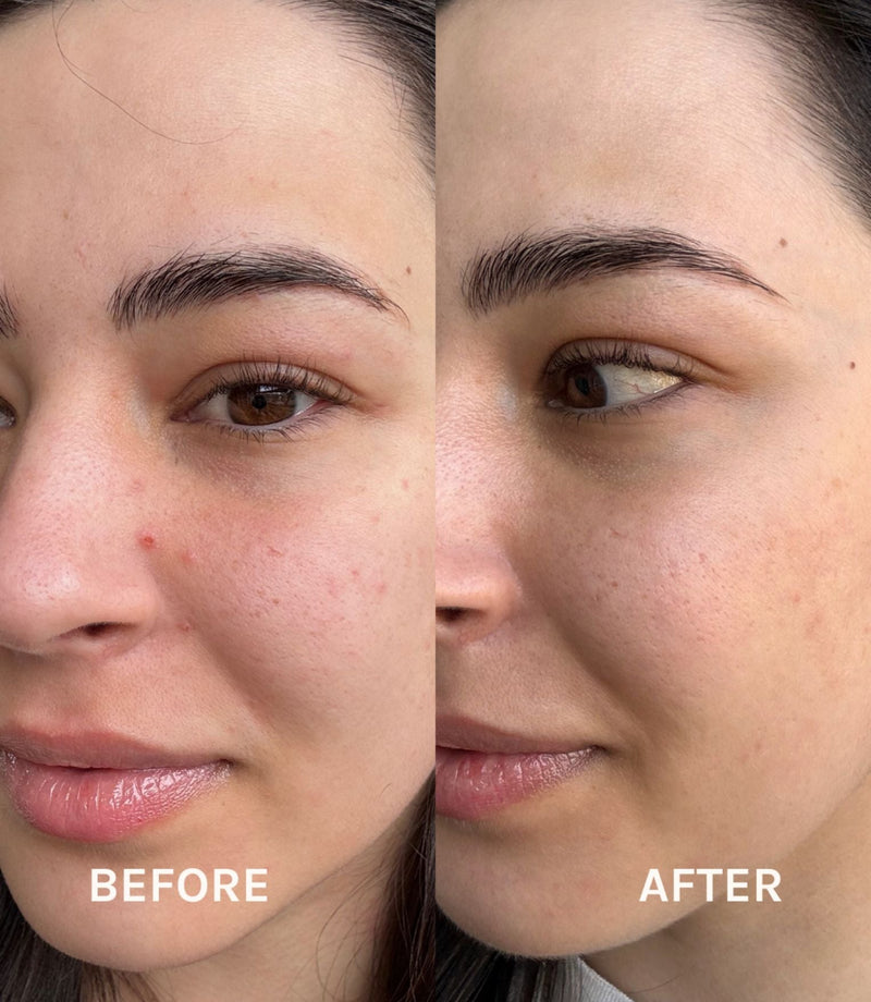 A313 Vitamin A Retinol Pommade 50g - French Beauty Co.A313