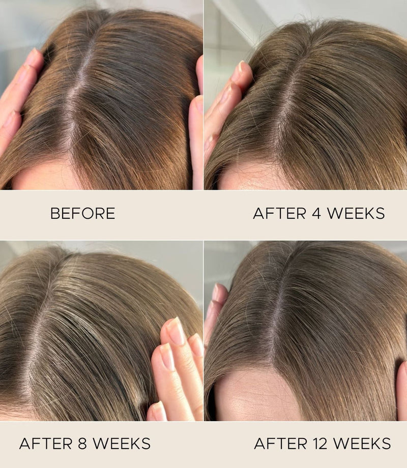 Fortifying Scalp Serum with Amaranth Peptides 50ml - French Beauty Co.Christophe Robin