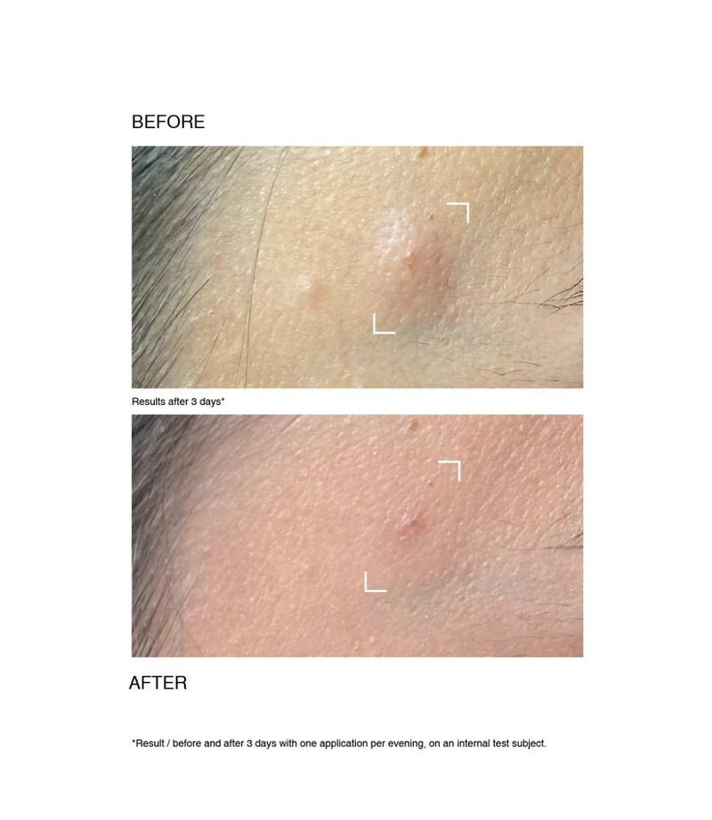 Pate Grise Special 5 Cica Drying Gel 15ml - French Beauty Co.Payot