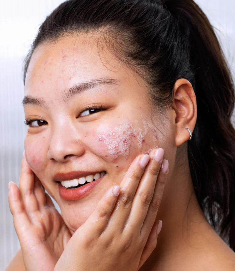 SEBIACLEAR Gel Moussant 400ml - French Beauty Co.SVR